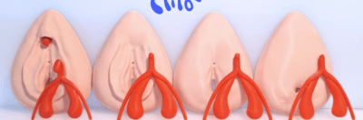 Discover the Female Genital Mutilation Educational Kit by the Clito project